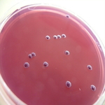 "Wrinkly" Colonies of Pseudomonas aeruginosa by Sophia Araujo